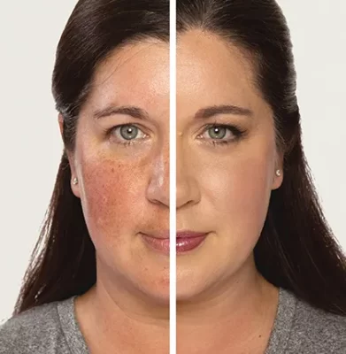 jane-iredale before and after